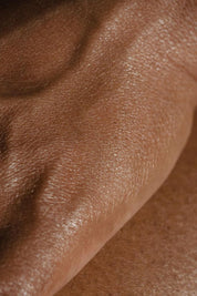 Laser Vein Treatment